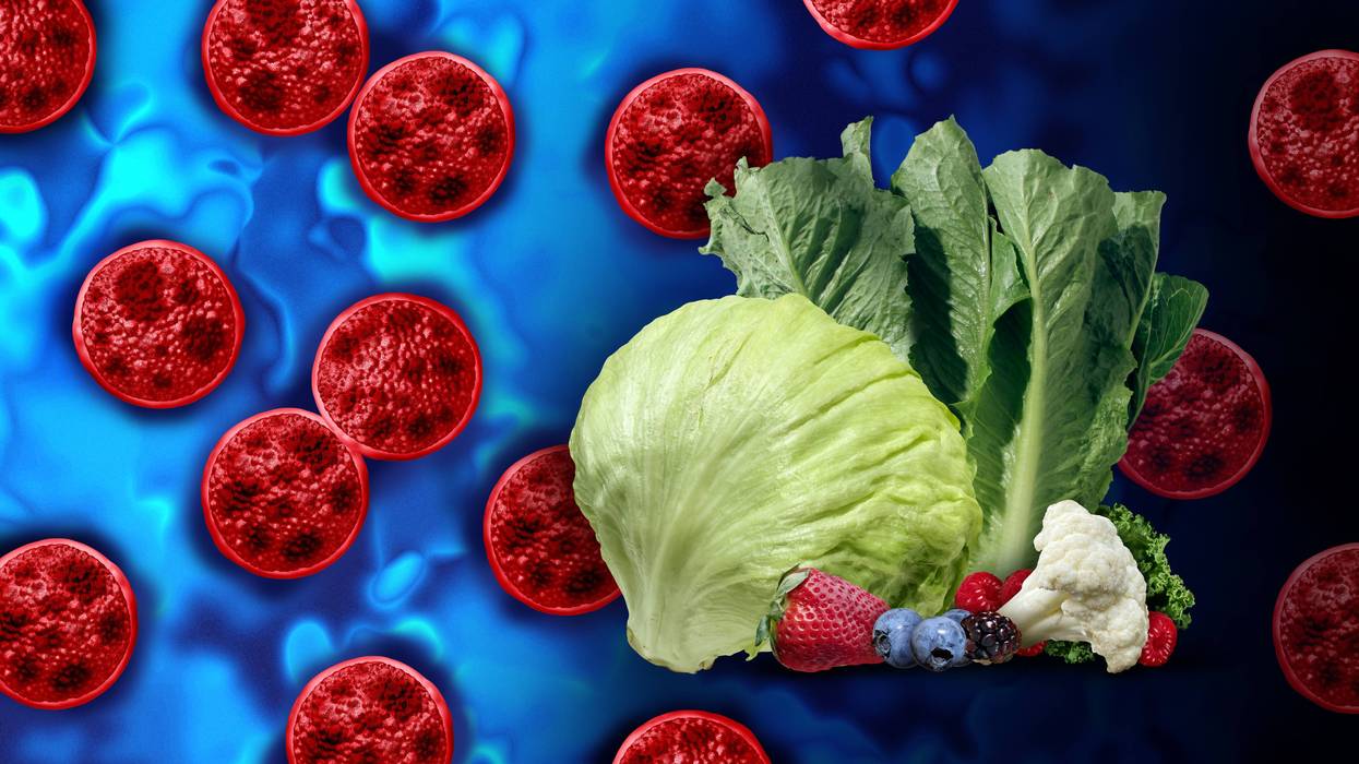 Louisiana’s 100 cases of cyclosporiasis far more than normal, but far less than other states
