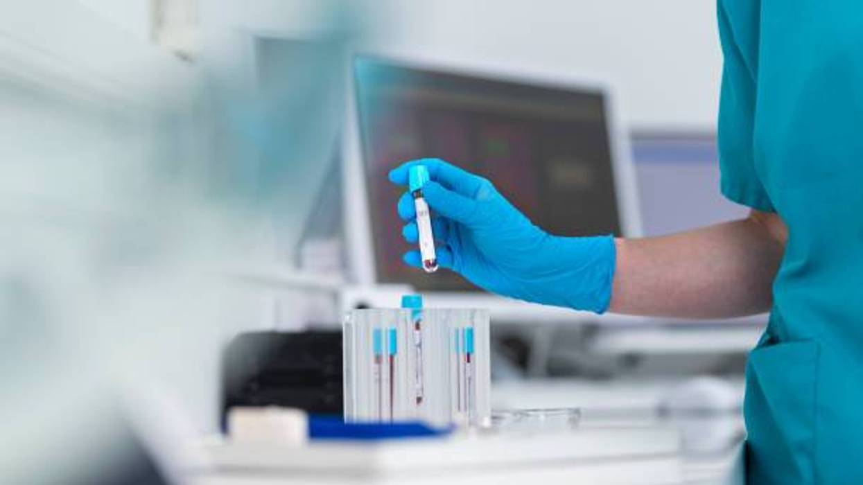 FDA clears Alzheimer's blood test developed at Washington University