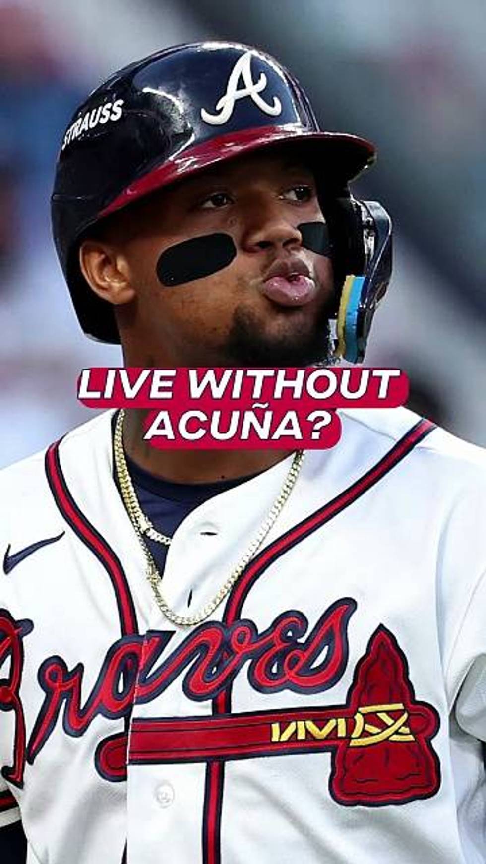 Could the Braves live without Acuña?