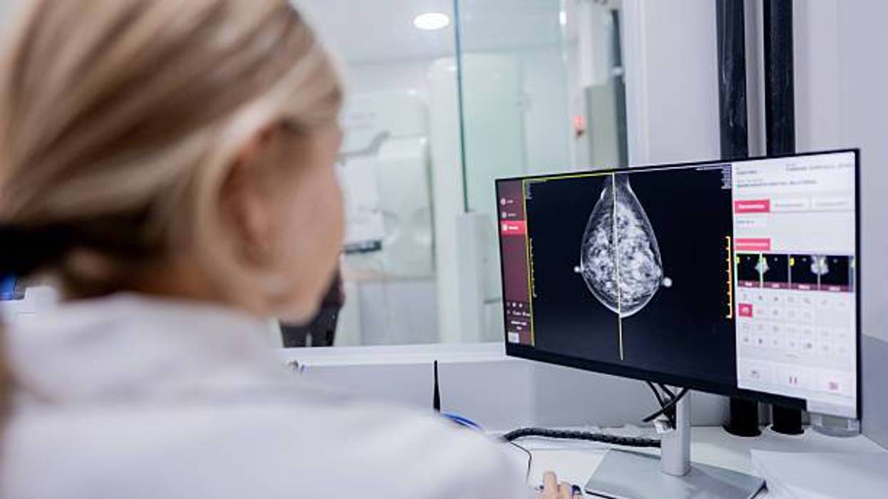 Doctors in St. Louis are seeing good results from a non-surgical method of killing breast tumors