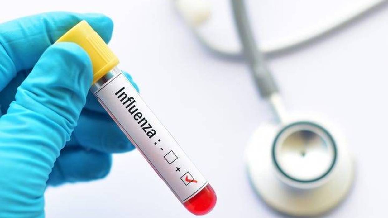 Influenza, Flu, health