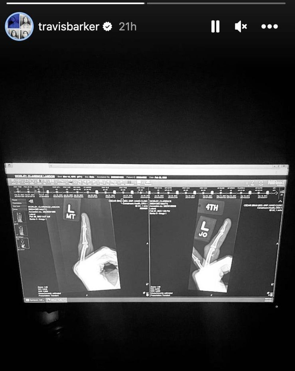 Instagram Stories/travisbarker