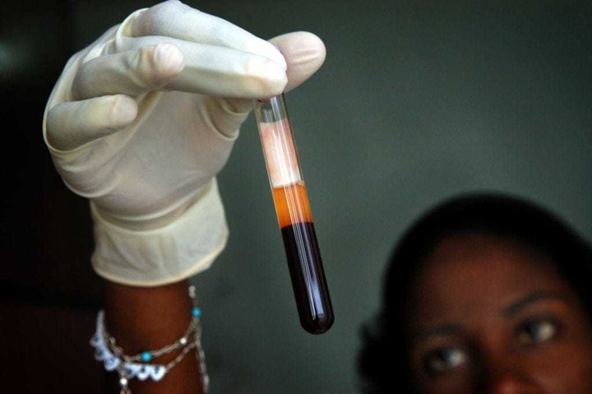 Jean Louis looks at a blood sample March 24, 2005 before it will tested at the lab of Zanmi Lasante Hospital in Cange, Haiti.