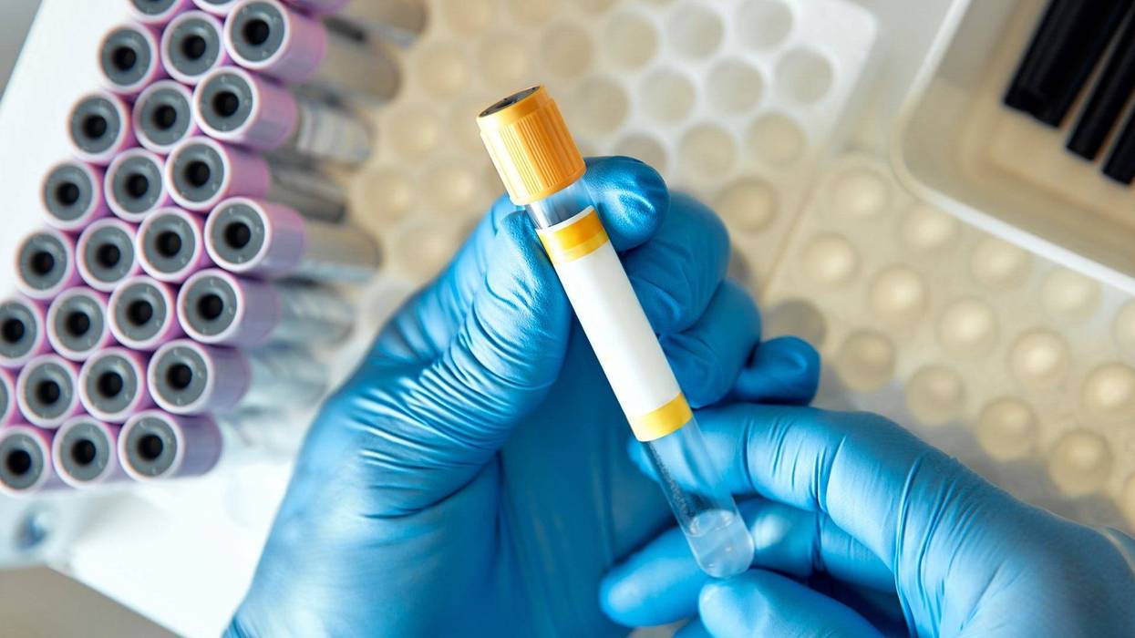 Laboratory tech handling blood test tubes - stock photo