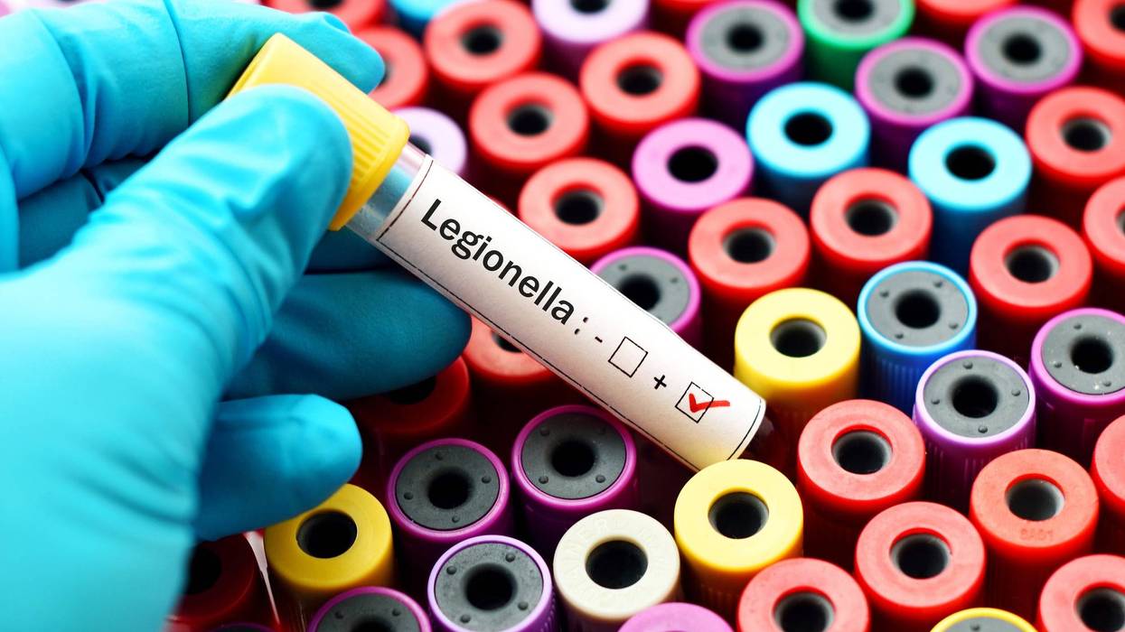 Legionalla test tube