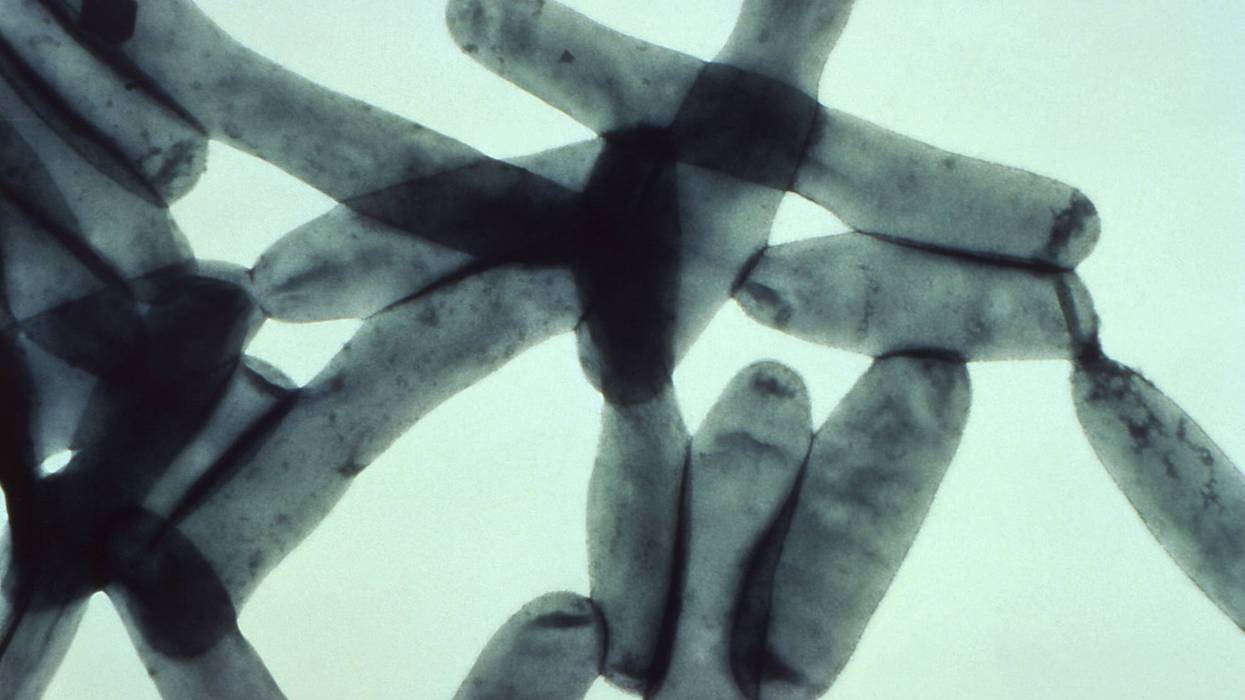 New cases slow in Legionnaires' outbreak; Met Museum among positive buildings