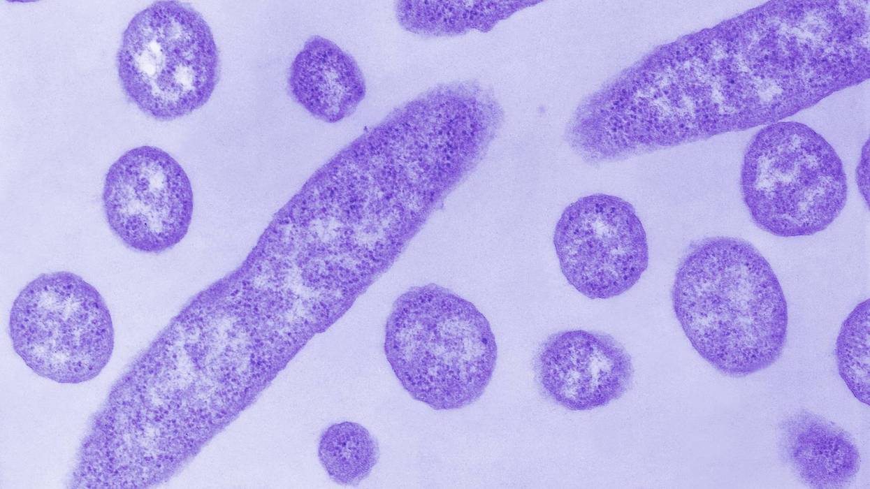 5th person dies in Legionnaires' disease outbreak in NYC