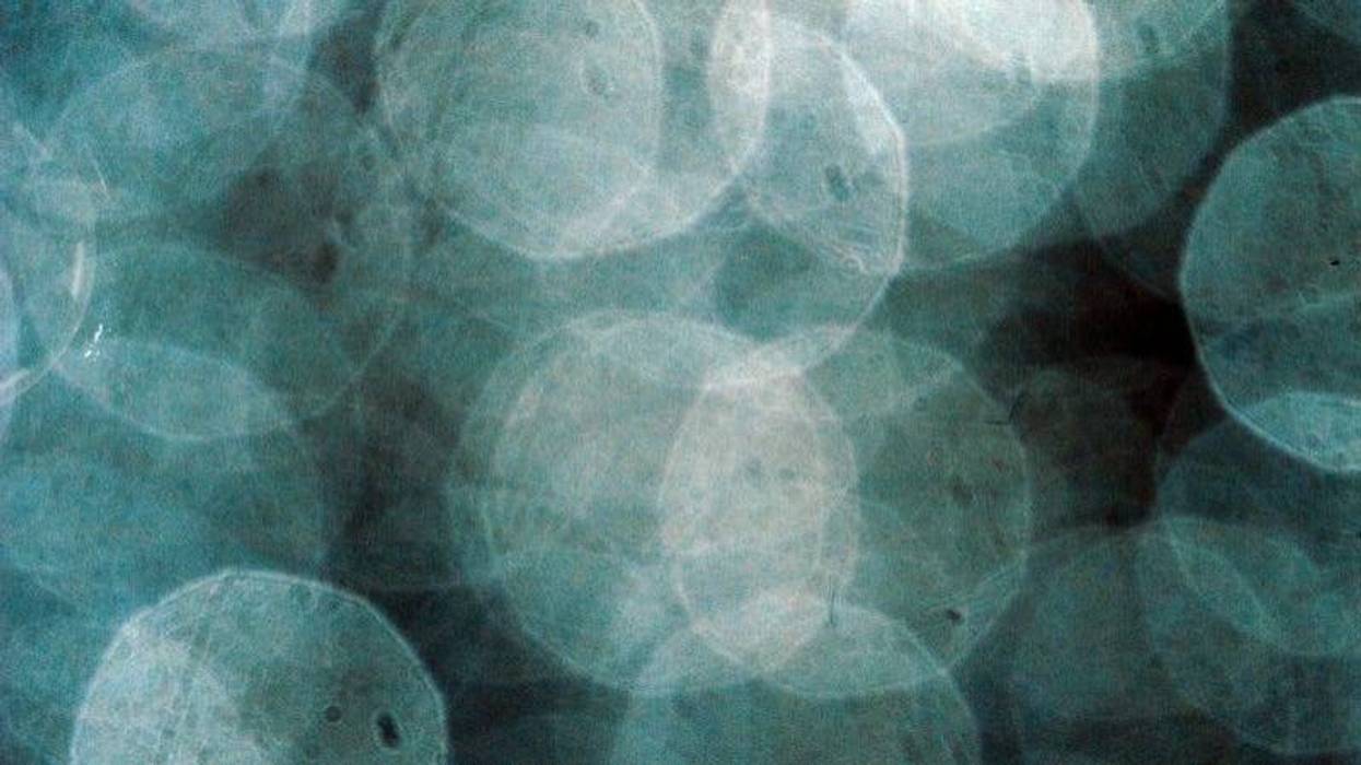 LIght spots getty images