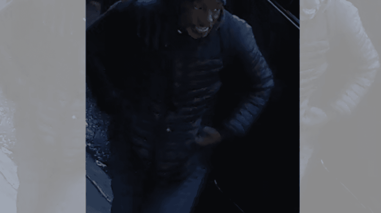 Man, 70, struck in head, robbed in broad daylight on Bronx street