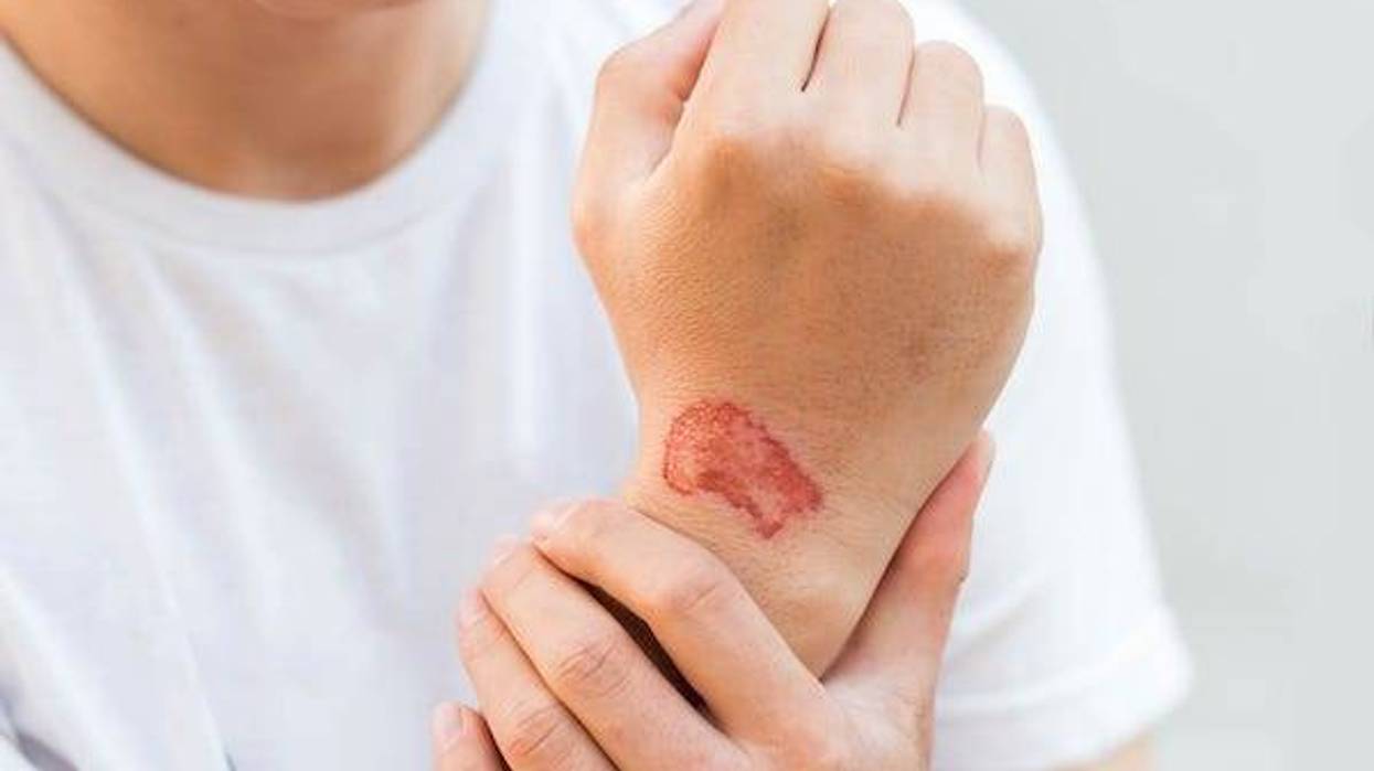 Man showing skin lesion at the doctor's office