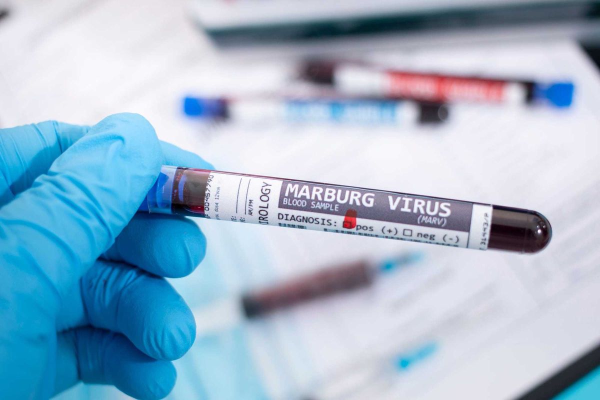Marburg virus