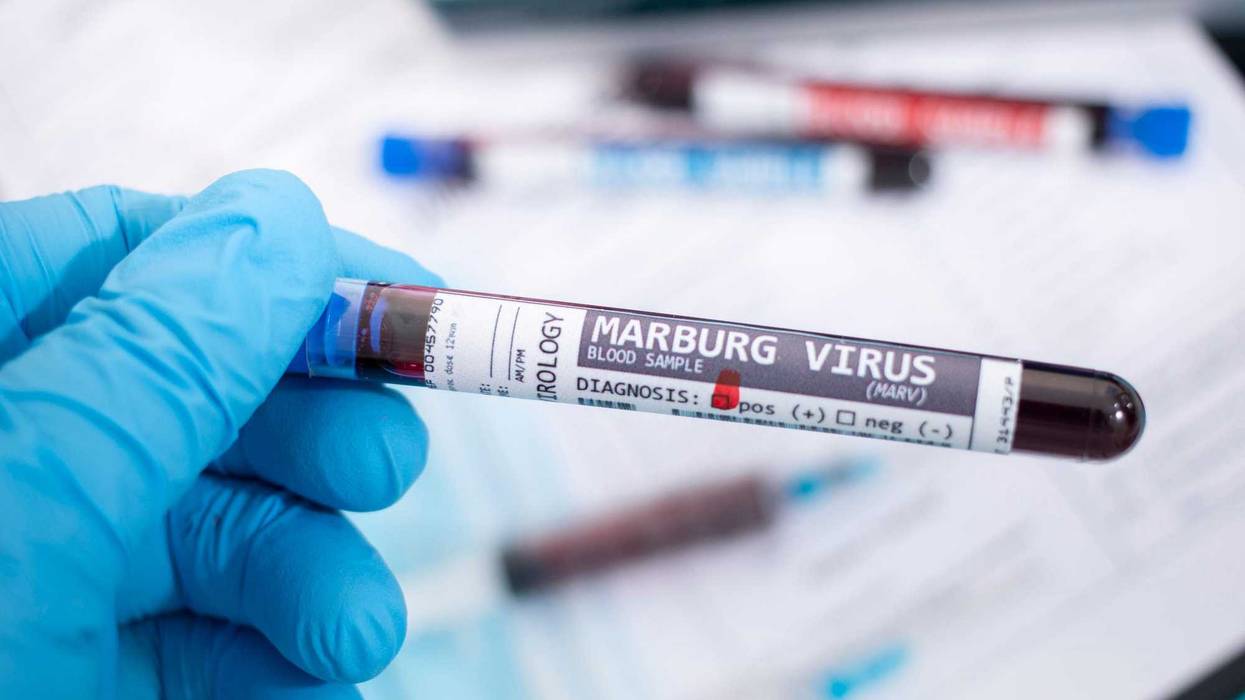 Marburg virus