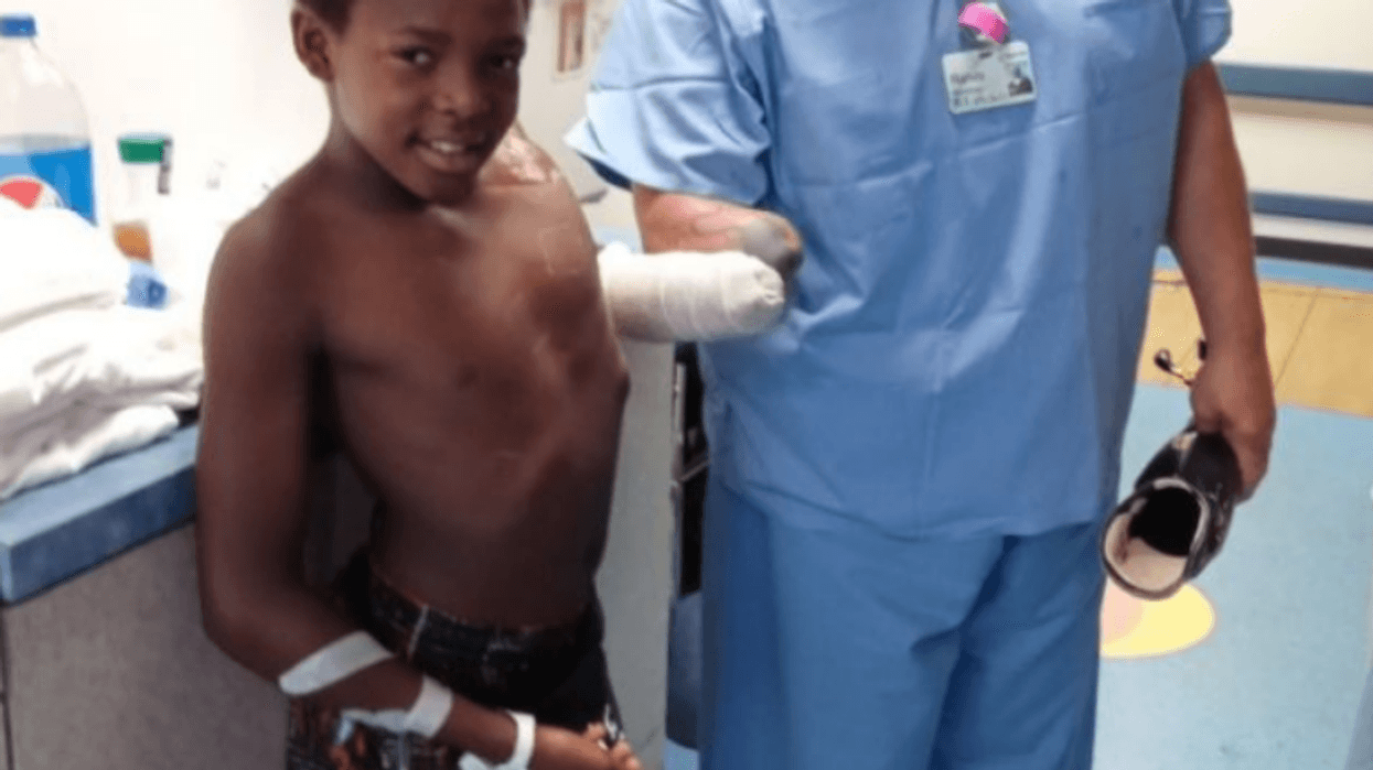 Martell Murchison lost his hand to a firework