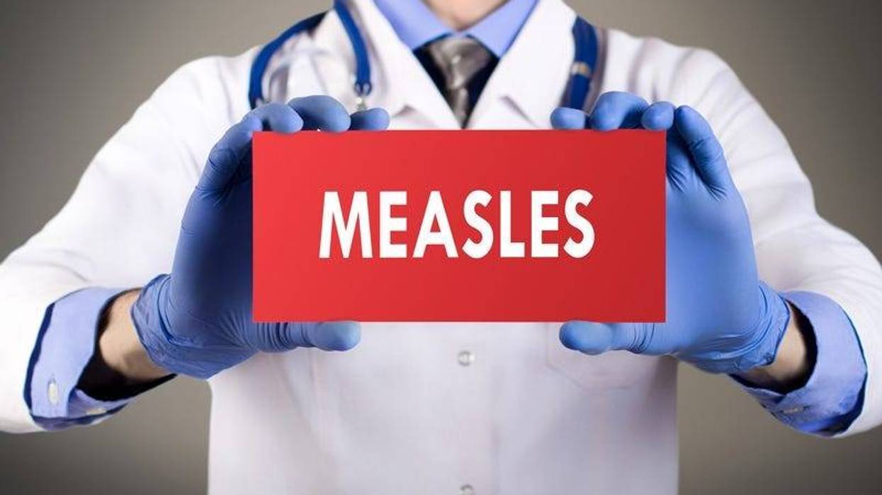 Measles
