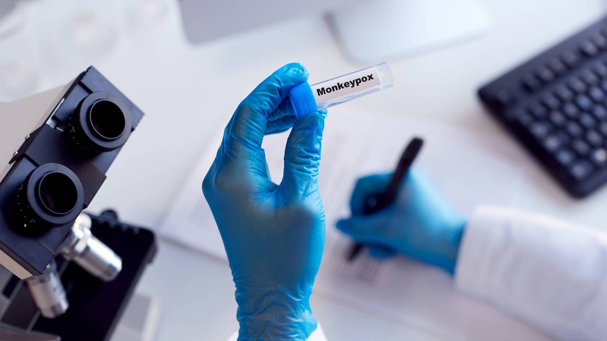 Monkeypox test