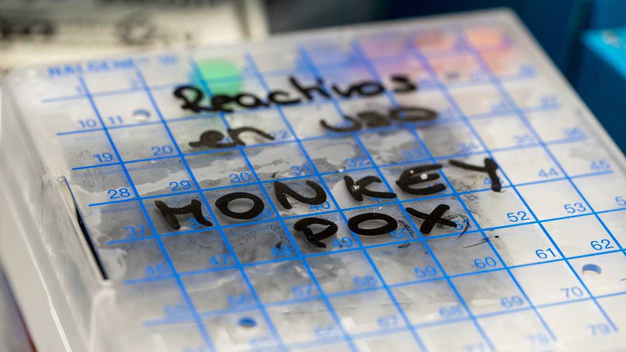 monkeypox