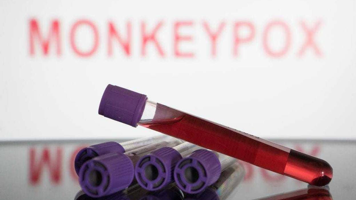 monkeypox