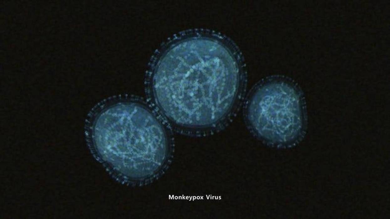 Monkeypox