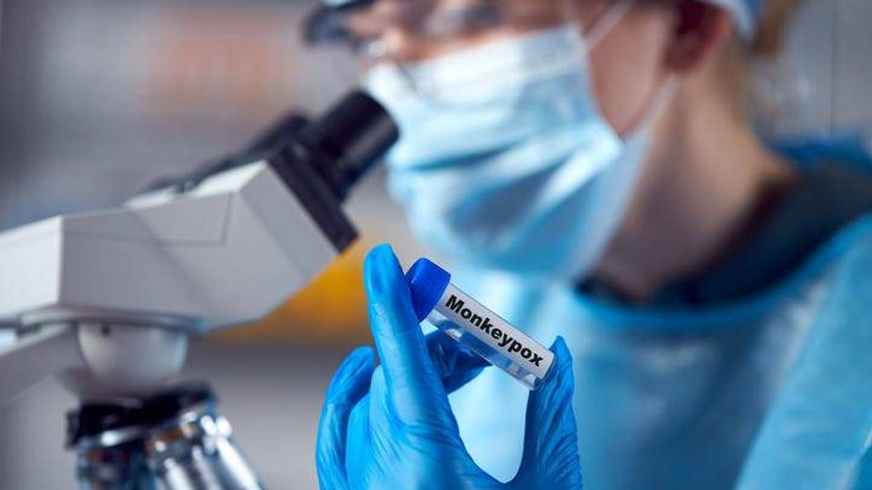 monkeypox