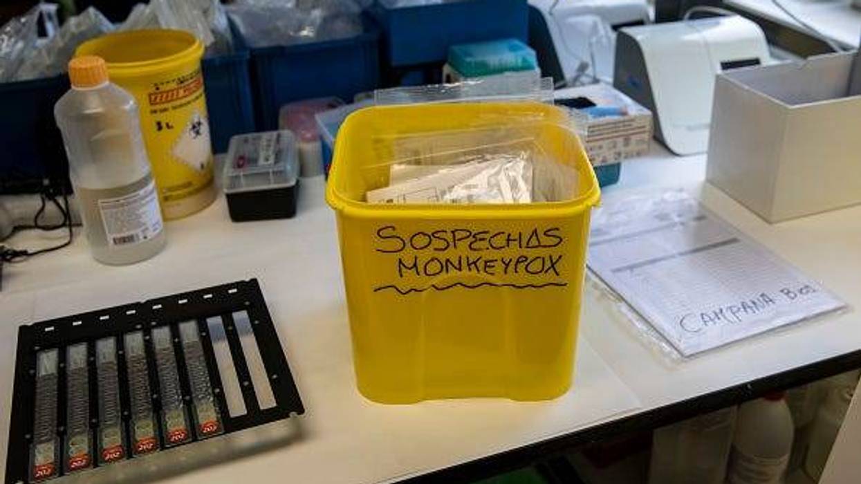 monkeypox