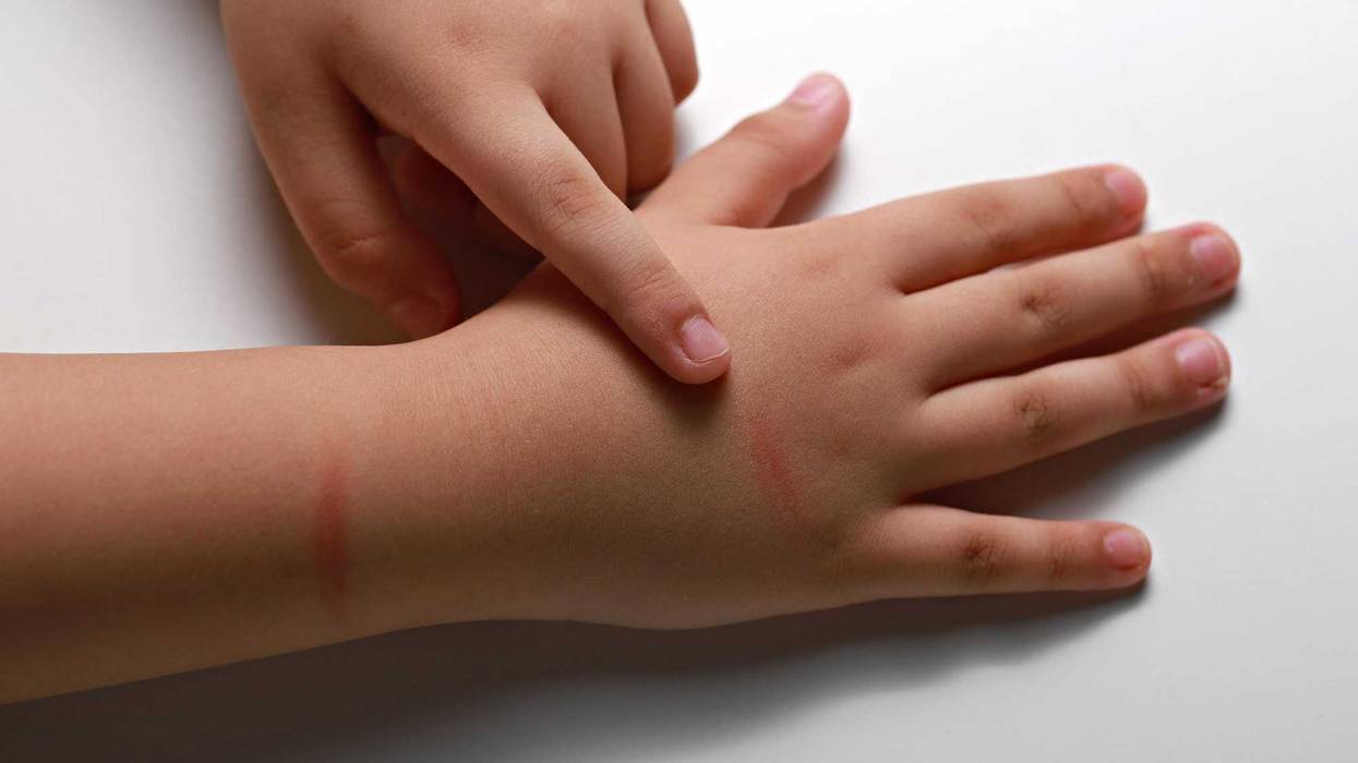 More volunteers needed for kids in need as child abuse cases surge in Kane County