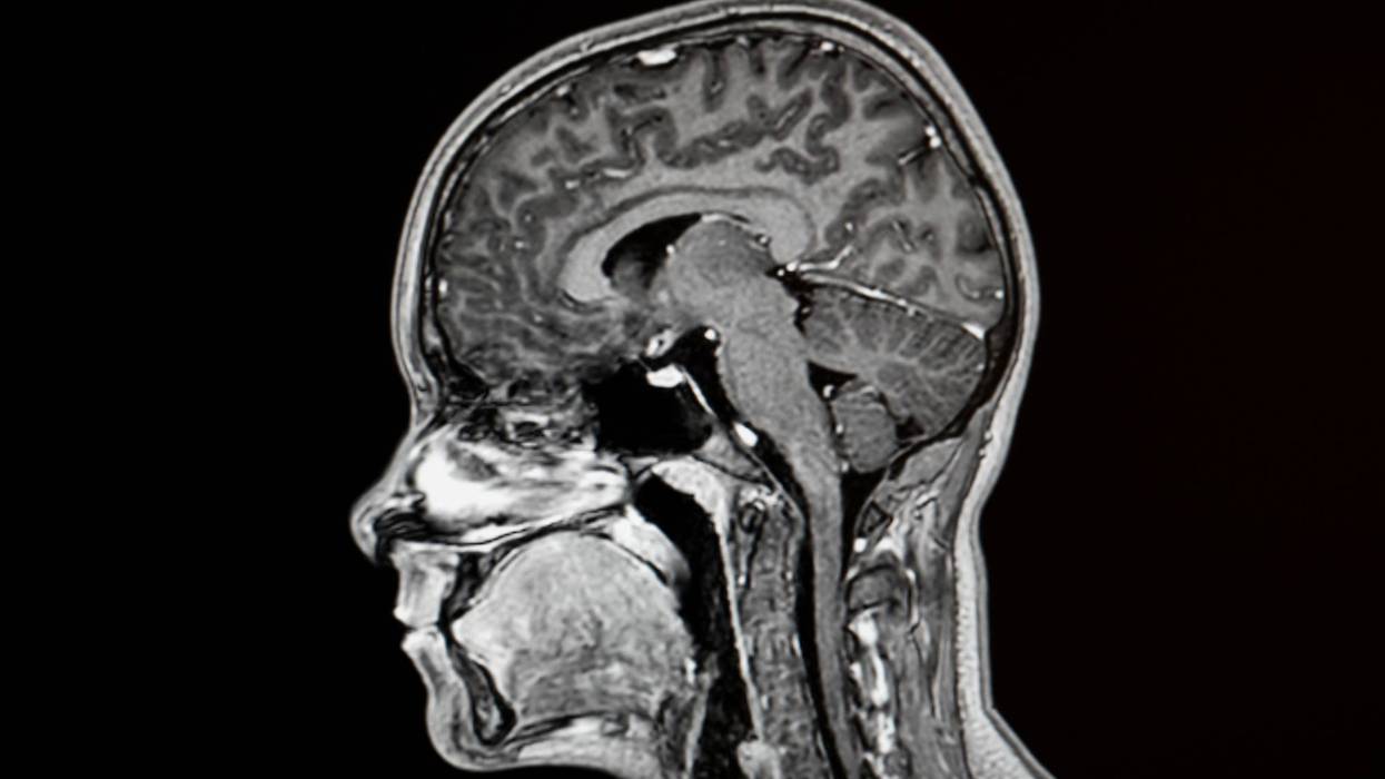 MRI of the human brain with contrast in lateral projection.