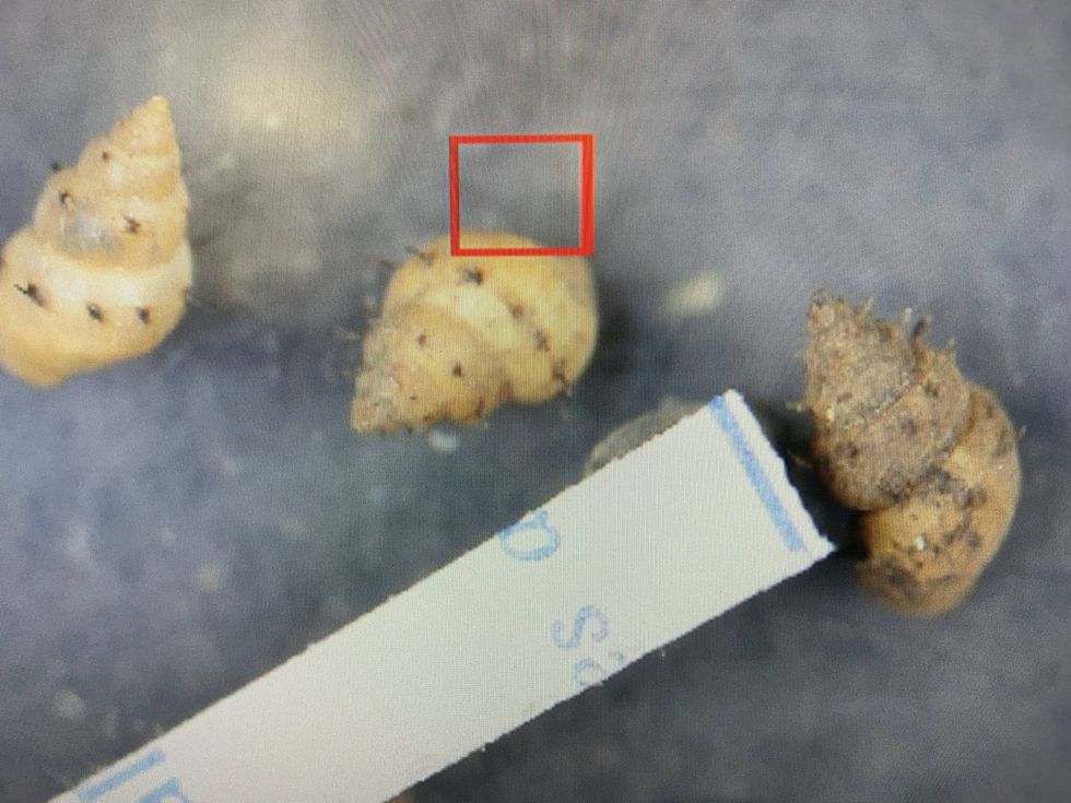 Mud snails under a microscope