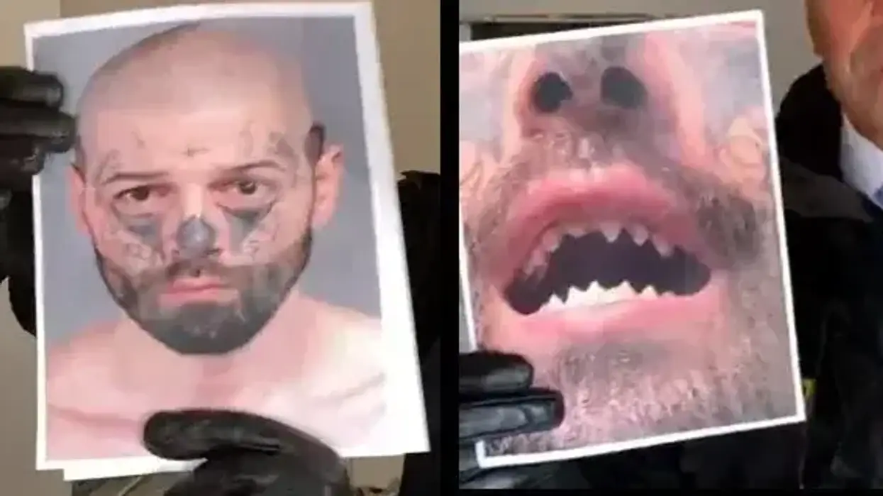 Mugshot of Michael Barajas and filed-down teeth