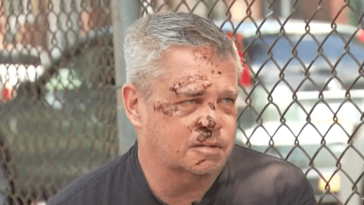 NBC10 spoke with the victim, 62-year-old Scott Harris, who said he was near his home when he was brutally beaten.
