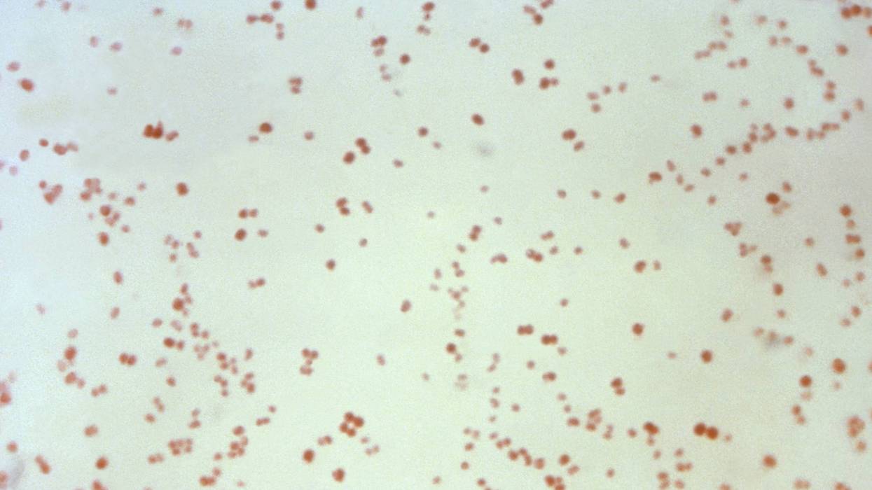 Neisseria gonorrhoeae bacteria, which causes the sexually transmitted disease gonorrhea