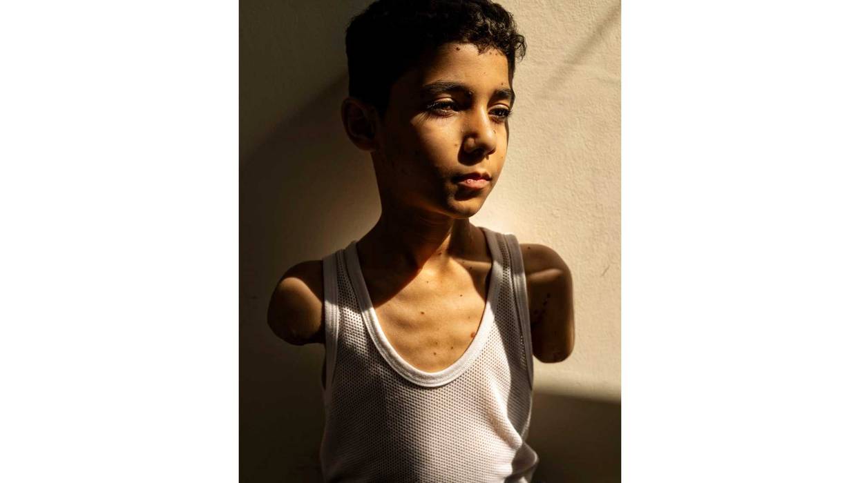 Netherlands World Press Photo