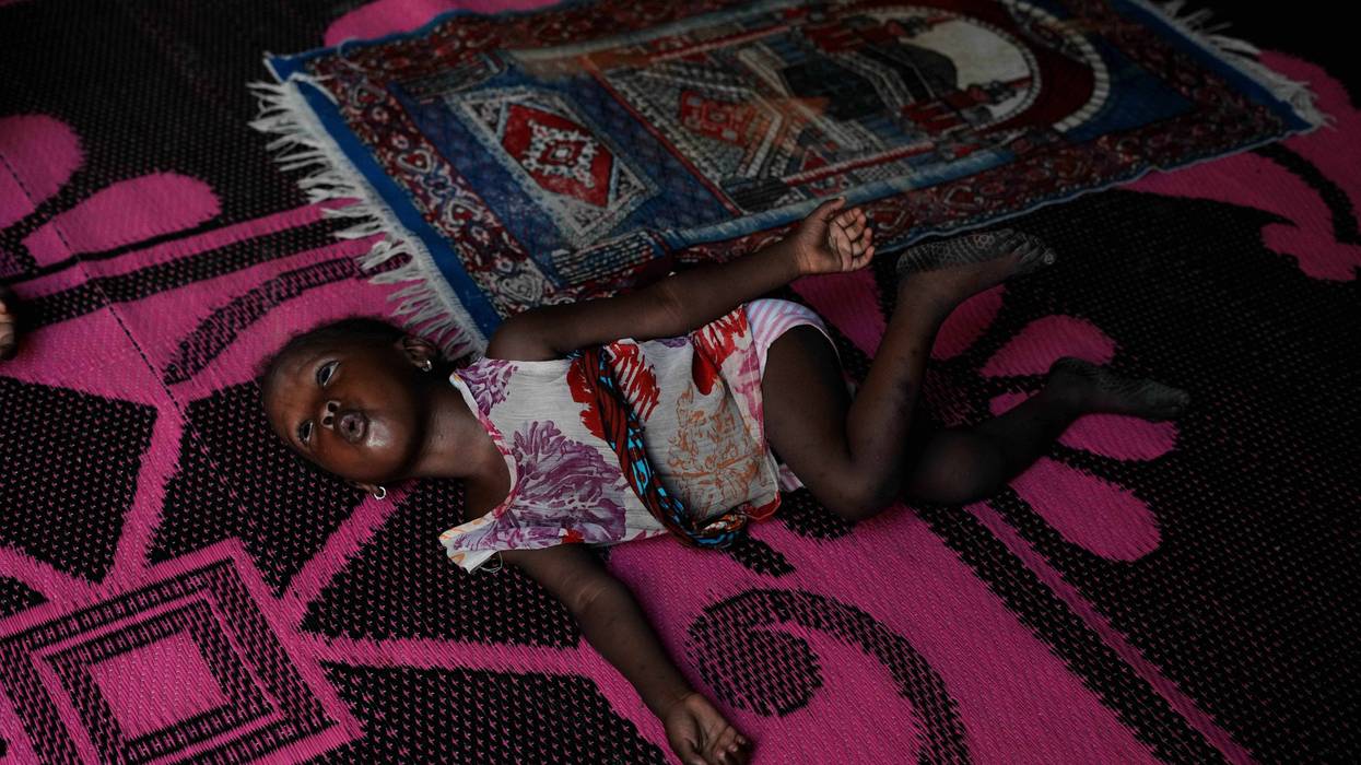 NIGERIA-GUERRA DE IRÁN-MALNUTRICIÓN 618