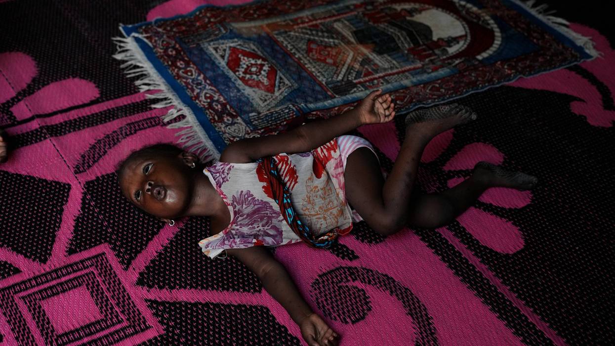 Nigeria Iran War Malnutrition