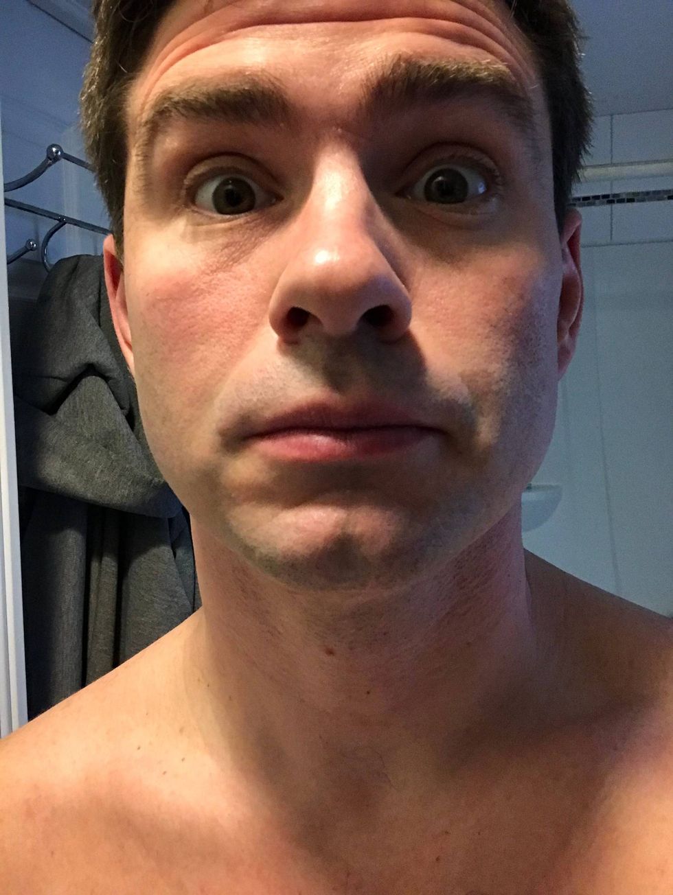 No facial hair left