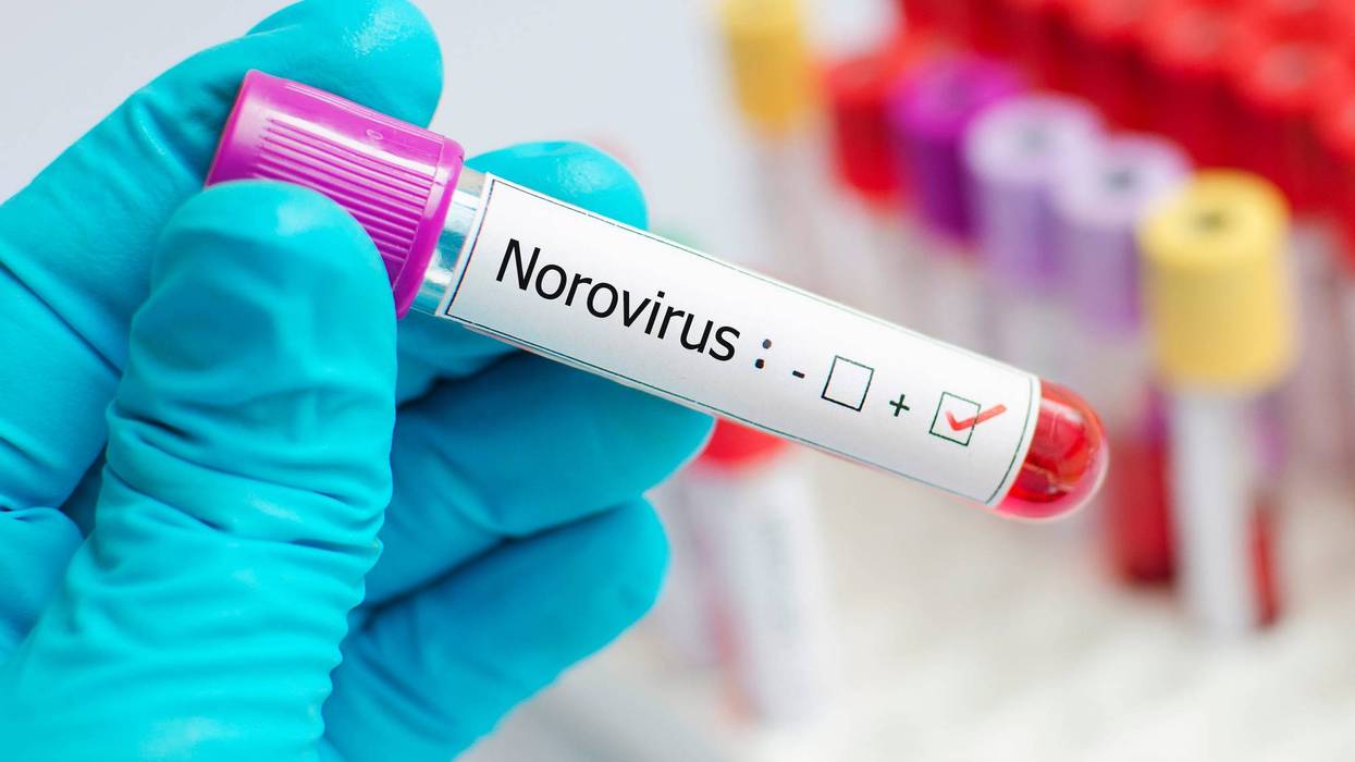 norovirus