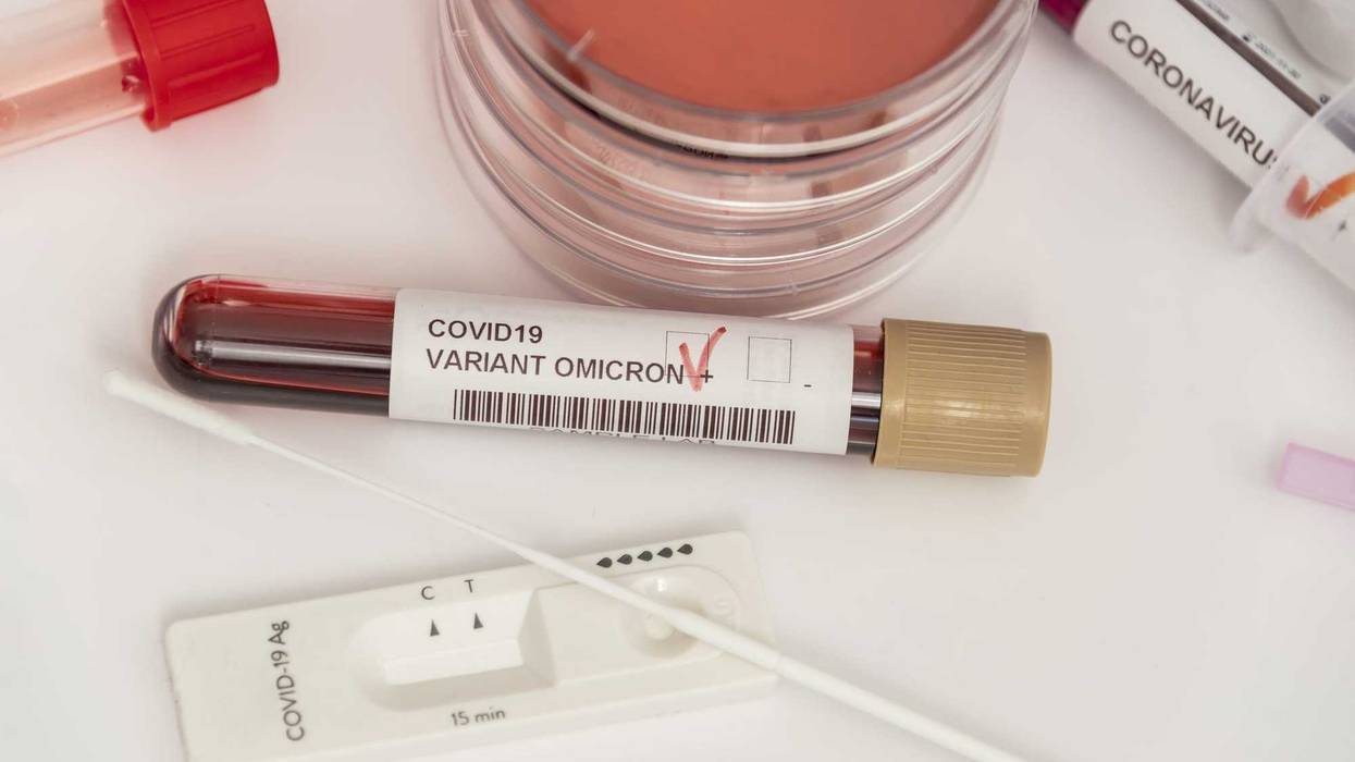 Omicron test sample stock photo.