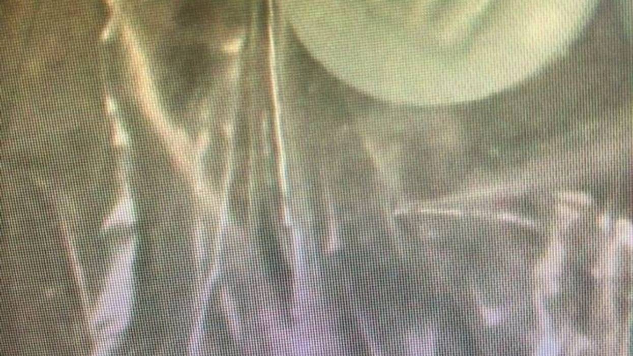 oxycodone/fentanyl