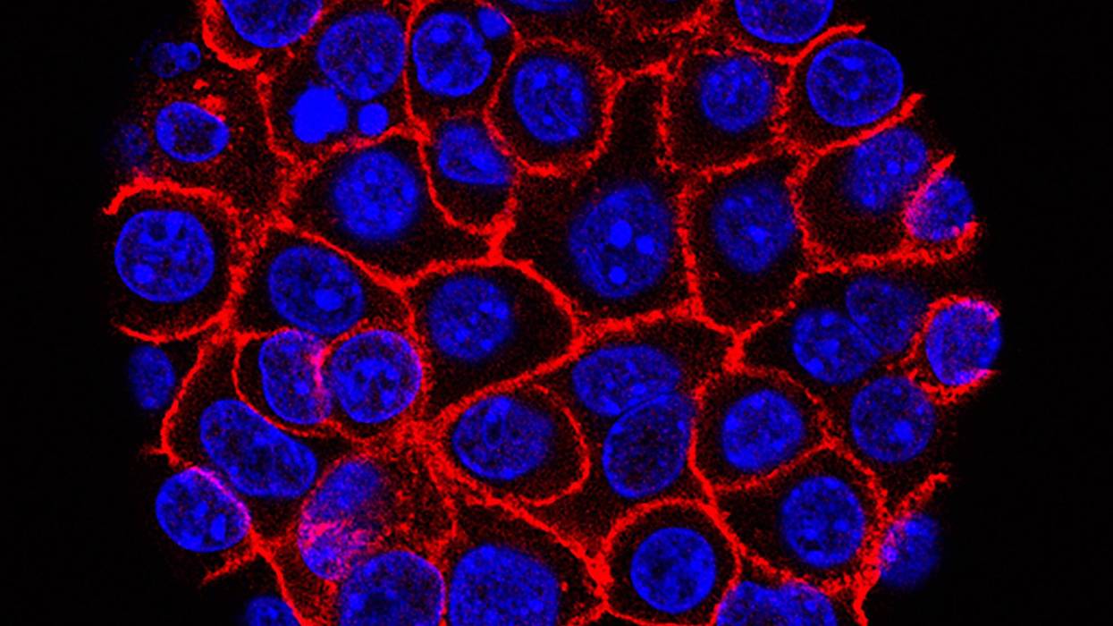 Pancreatic Cancer Drug