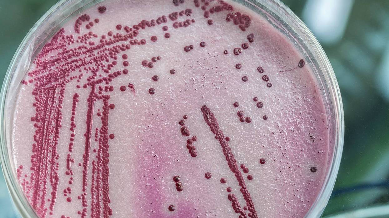 Petri dish full of pink and red microbacterias.