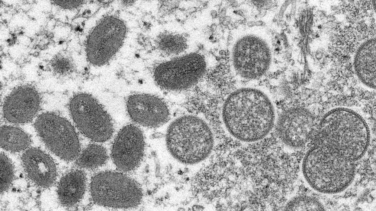 Portugal Monkeypox