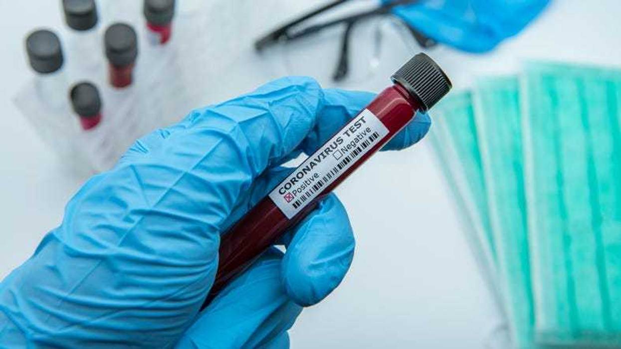 Positive covid-19 test.