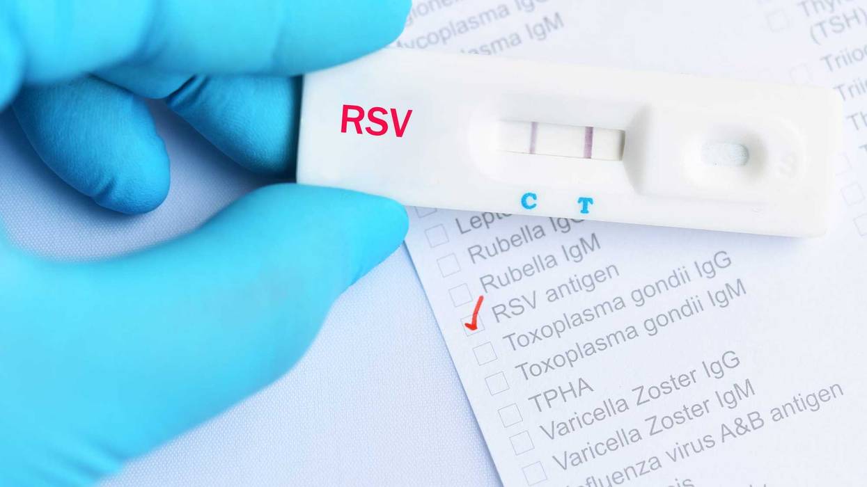 Positive RSV test