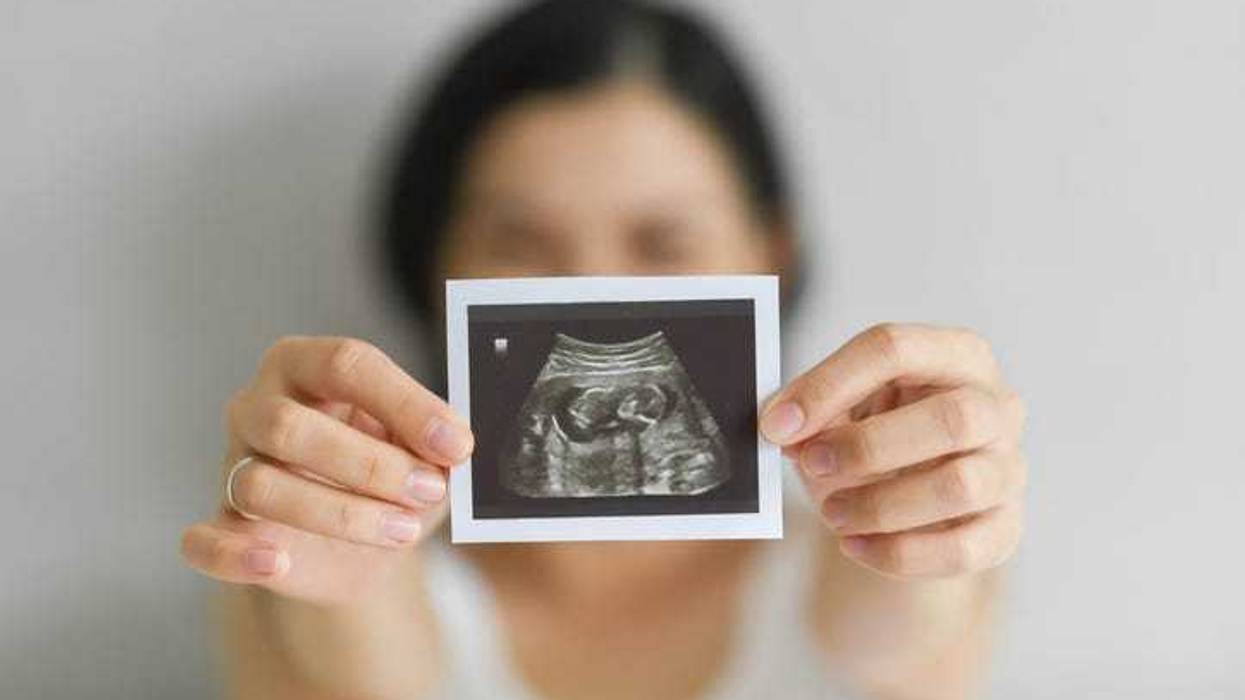 pregnancy ultrasound