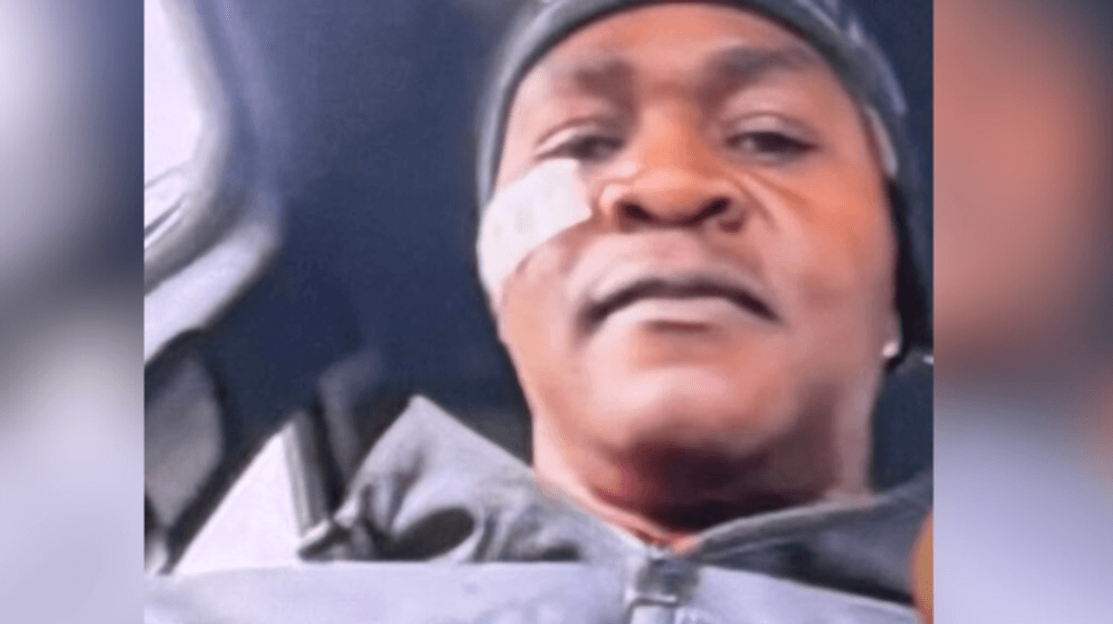Prince Ezenekwe, a 54-year-old livery cab driver was shot in the cheek by a passenger during a dispute in Brooklyn.