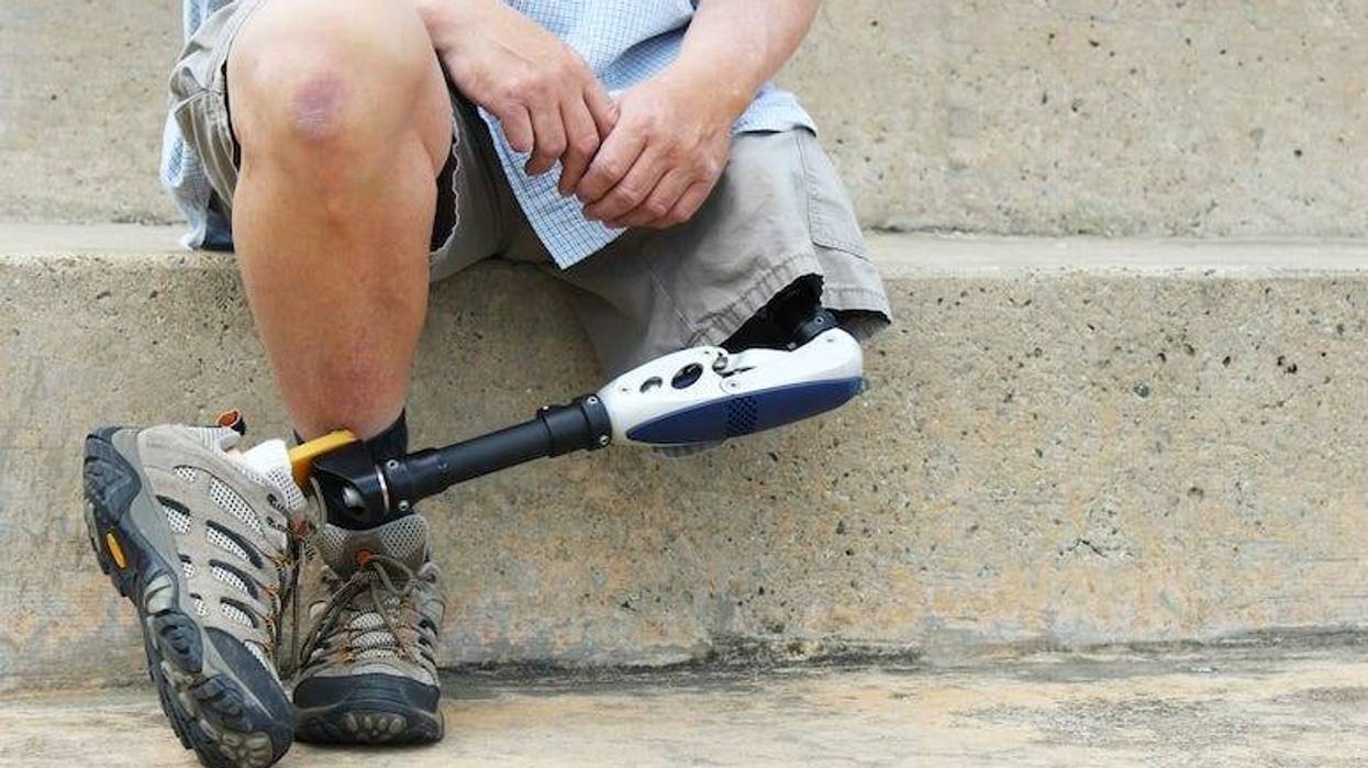 Prosthetic Leg, Man, Legs, Sitting