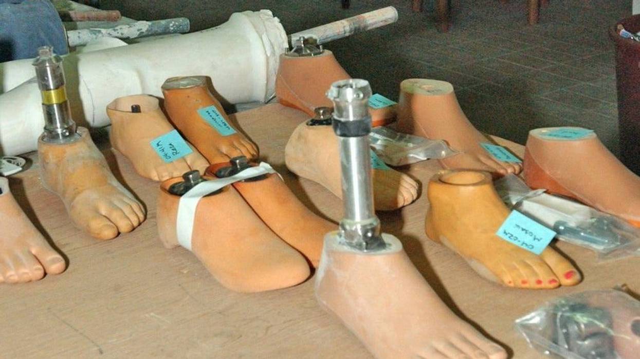 Prosthetics