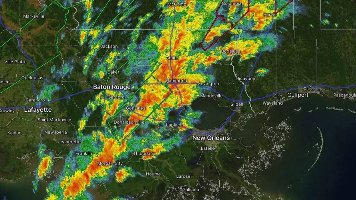 Radar