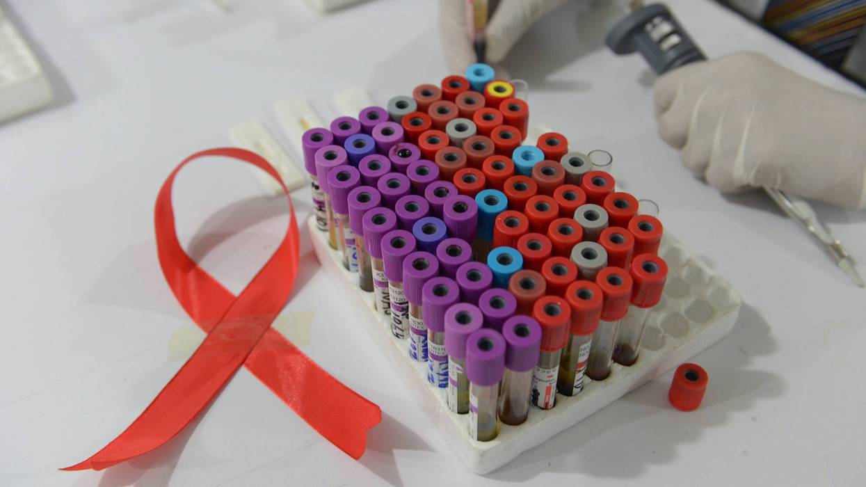 Researchers have successfully eliminated HIV from the DNA of infected mice, a promising step toward a cure for the nearly 37 million people living with the virus.