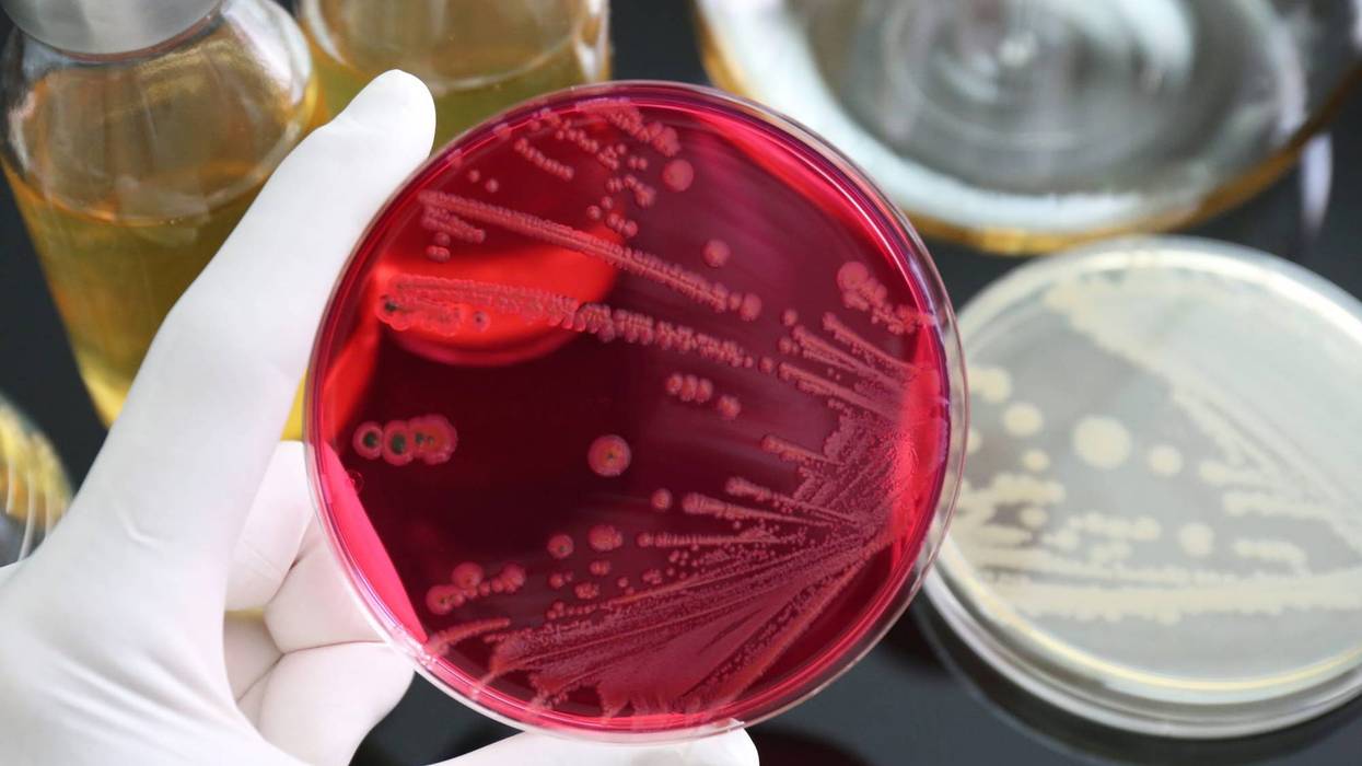 Salmonella outbreak hits 23 states