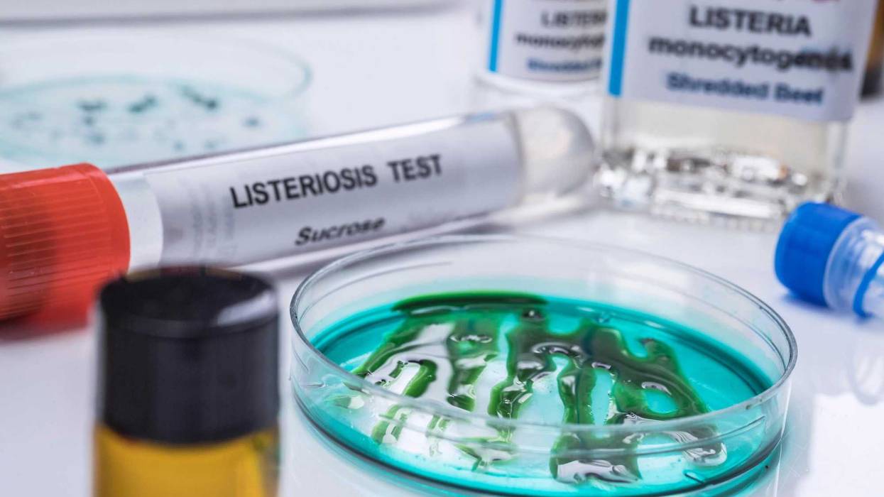 Samples you analyze of stuffed meat contaminated by bacterium of listeria in laboratory